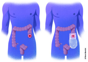 Dr. Kohen Mohamed en chirurgie du cancer digestif à Casablanca.