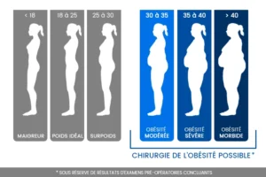 Bypass gastrique à Casablanca Maroc avec Dr.Kohen Mohamed